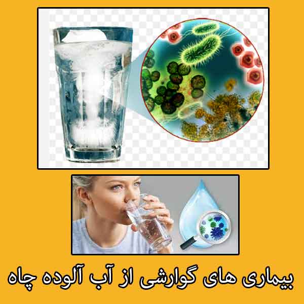 بیماری‌های گوارشی ناشی از مصرف آب آلوده